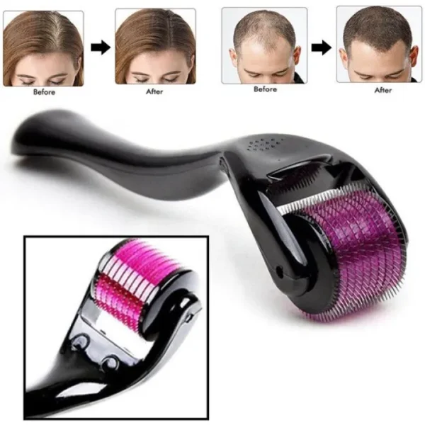 Derma Roller 0.5mm for Hair & Skin Therapy | 540 Titanium Micro-Needles thumbnail 4