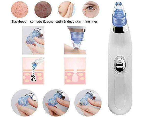 Blackhead Removal Machine | Derma Suction 3 In 1 Black Head Remover Machine | Acne Pimple Pore Cleaner Vacuum Suction Tool thumbnail 4