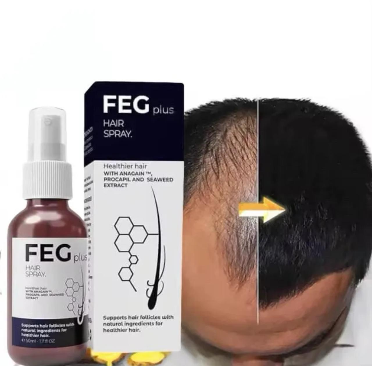 FEG PLUS Hair & Beard Regrowth Spray – Anti Hair Loss Formula with Minoxidil, Redensyl & Natural Extracts (50ml) thumbnail 5
